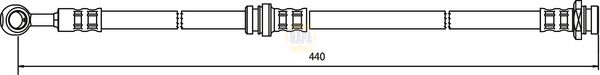 Napa NBH1305 Brake Hose - 1